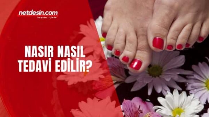 Nasır Nasıl Geçer Bitkisel Krem Tarifi