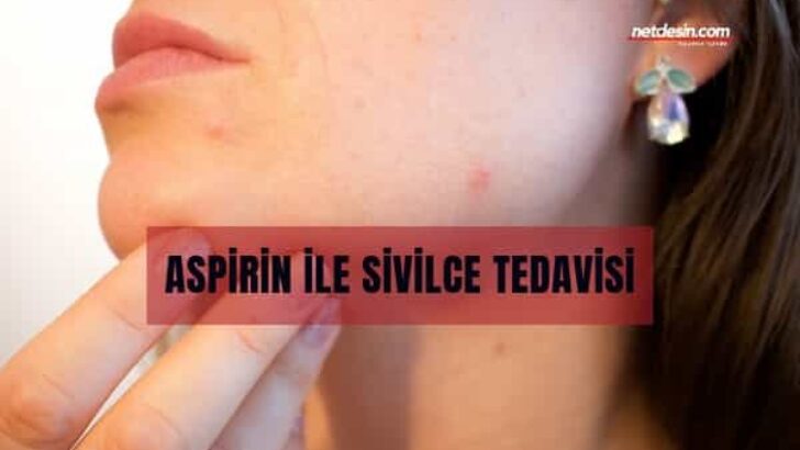 Aspirinle Sivilce Nasıl Geçer?