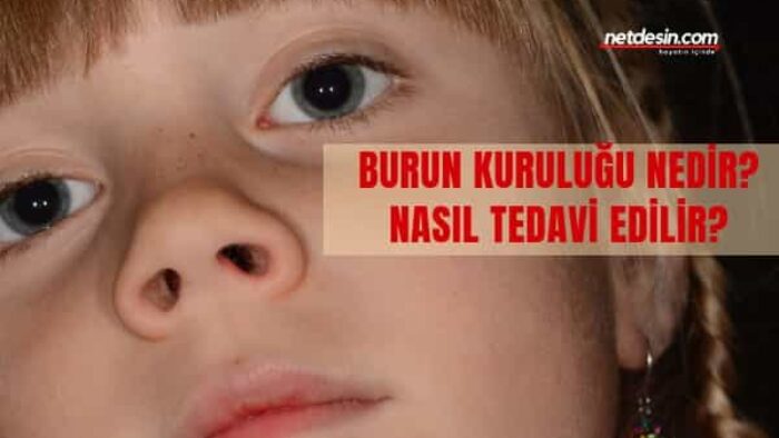 Burun Kuruluğu Nedir?