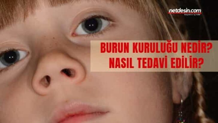 Burun Kuruluğu Nedir?