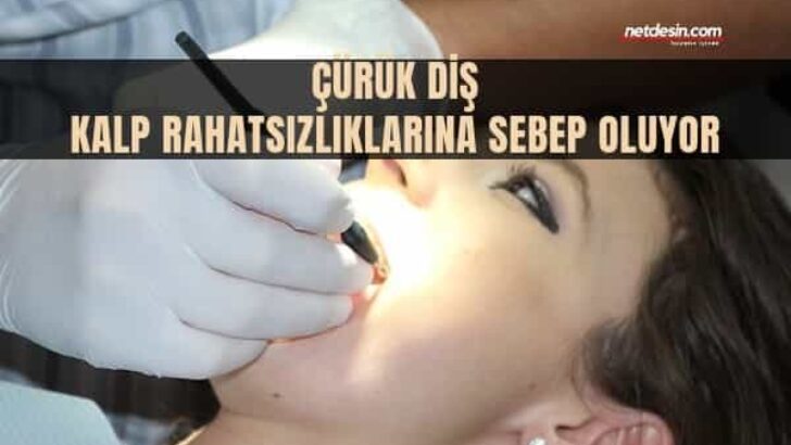 Çürük Diş Kalp Rahatsızlıklarına Sebep Oluyor