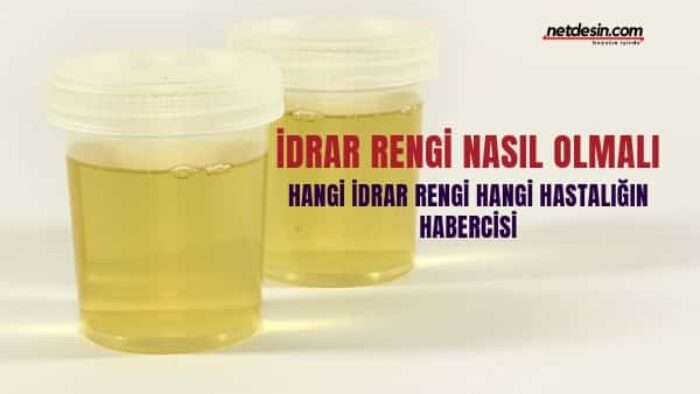 İdrar Rengi Hangi Hastalığın Habercisi