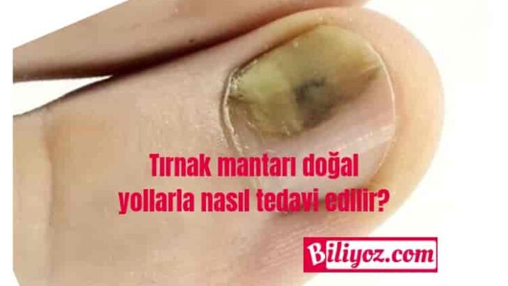 Tırnak Mantarı Tedavi Yöntemleri Nelerdir?