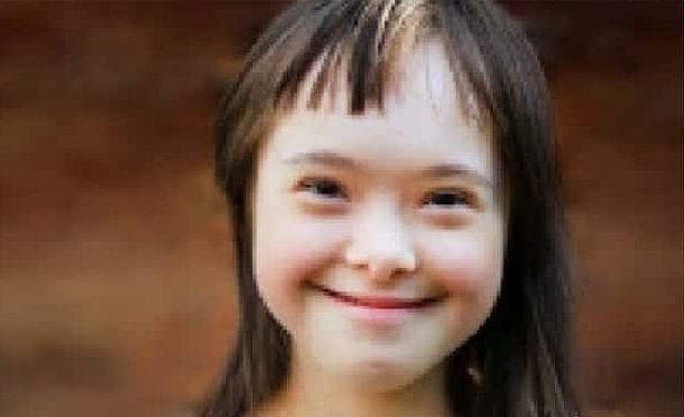 Anne Karnında Down Sendromlu Bebek Hareketleri
