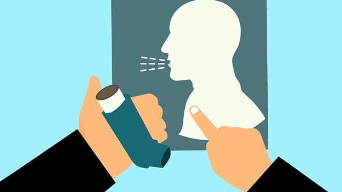 Astım Hastalığı Nedir? Genel Bilgiler